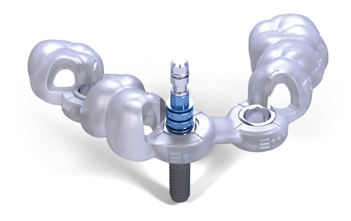 cirugia-guiada-implantes-alicante